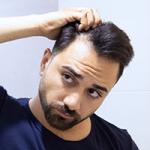 Man looking at hair loss in mirror